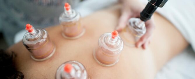 Looking for a Registered Acupuncturist in Coquitlam?