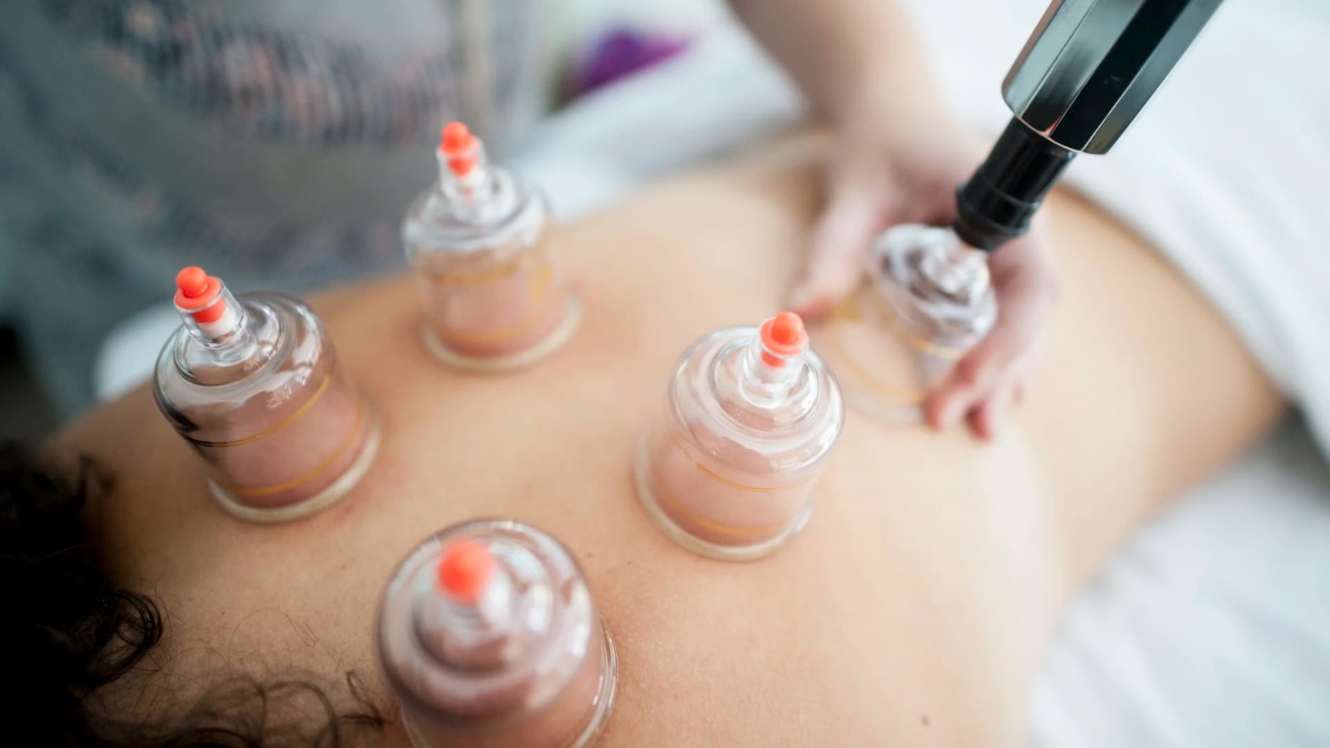 Looking for a Registered Acupuncturist in Coquitlam?