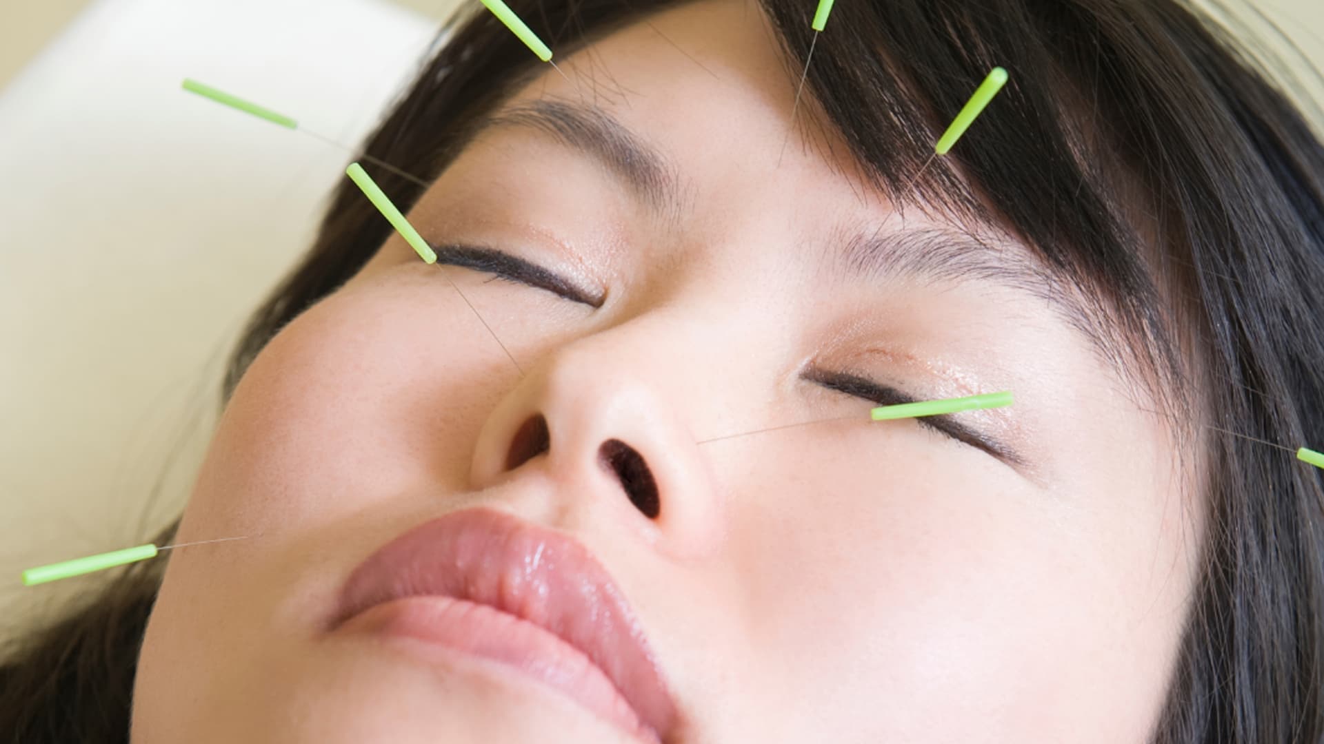 Embrace your Unique Beauty with Cosmetic Acupuncture