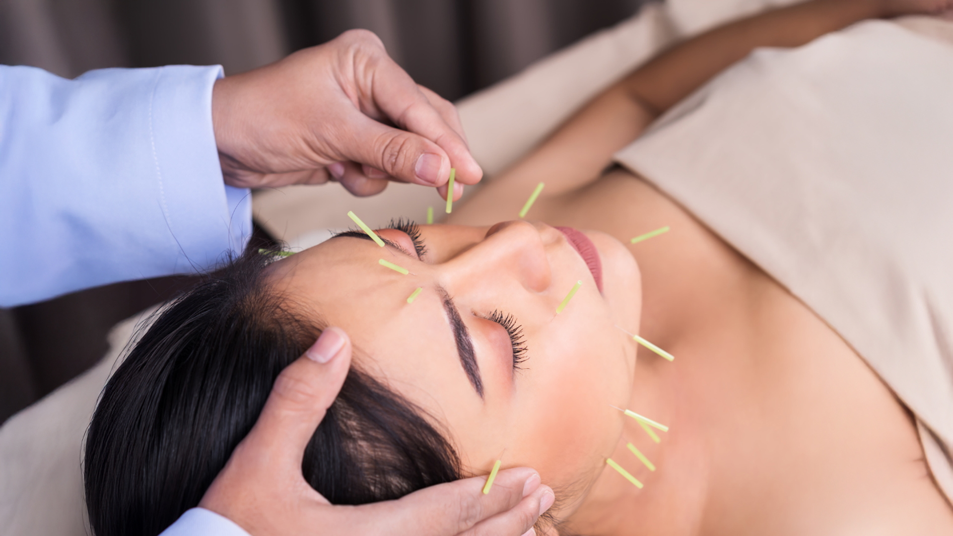 Facial Rejuvenation Acupuncture: Enhancing Beauty and Wellness from Within