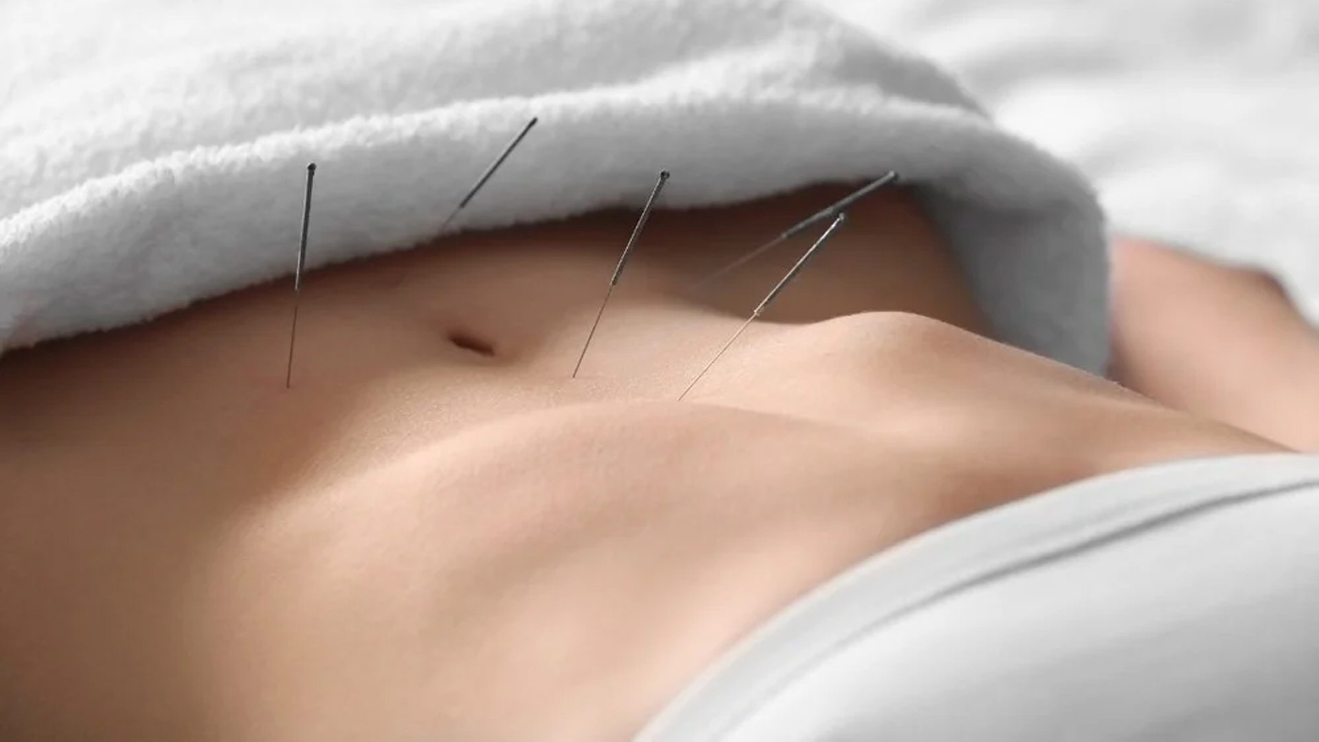 Fertility Acupuncture Coquitlam: Natural Support for Conception and IVF